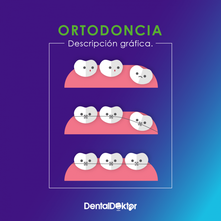 DentalDoktor Casos de éxito Si Señor Agencia